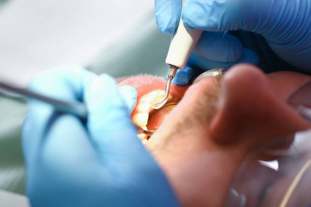 Best Emergency Root Canal Therapy in Vilonia, AR