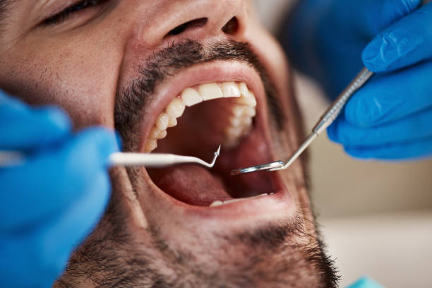 Best Emergency Cosmetic Dentistry (e.g., broken veneers) in Vilonia, AR
