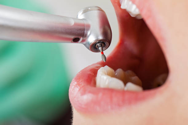 Best Emergency Denture Repair in Vilonia, AR